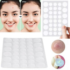 UP 720X Spot Patches,Dots for